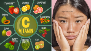 khasiat vitamin C