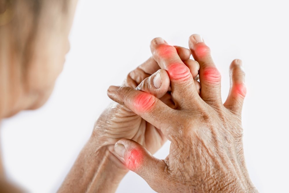 Punca Gout, Tanda-Tandanya Serta Rawatan Yang Perlu